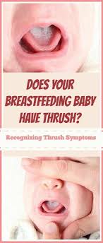 Recognizing Thrush Symptoms When Breastfeeding And Treatment Options Baby Breastfeeding Breastfeeding Thrush Symptoms