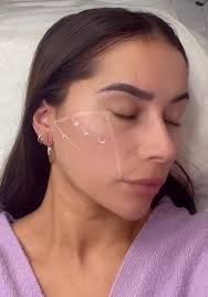 Face Mapping 📐 How to mark up for cheek filler ready for needle 💉 We  offer a range of facial contour courses using needle or cannula DM TO BOOK  ✅ #cheekfiller #cheekfillers #facefillers #facemapping ...