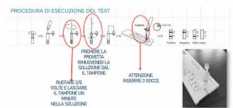 Posted on 9 απριλίου, 20219 απριλίου, 2021 by panos.theodor131@gmail.com. Test Antigenico Rapido Per Covid 19 Farmaspeed It