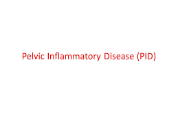 Pelvic Inflammatory Disease Pid Ppt Video Online Download