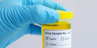 We did not find results for: Waspadai Penyebab Urine Berwarna Hijau Merah Ungu Oranye Dan Seperti Teh Halaman All Kompas Com