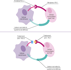 L'immunothérapie spécifique par anticorps monoclonaux est indiquée dans le traitement de certains mélanomes l'immunothérapie par interféron n'est pas recommandée dans certaines situations. Immunotherapie Mode D Action Therapies Ciblees Et Immunotherapie Specifique