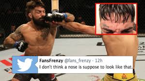 Vicente luque drops niko price with a vicious right hand. Mike Perry Suffered One Of The Worst Nsfw Broken Noses You Ll See In Loss To Vicente Luque Article Bardown