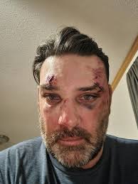 Be careful yall and always ride with a helmet (Not my pics)