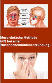 Diese Einfache Methode Hilft Bei Einer Nasennebenhohlenentzundung Beauty Hacks Sinusitis Hacks