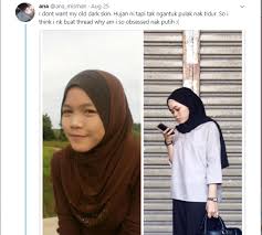 Macam mana nak kongsi dengan korang semua macam mana nak buat projek berskala kecik atau besar dekat. Sering Diejek Hitam Gadis Ini Obses Mahu Putih Mynewshub