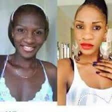 Black And White Bleaching Cream Results Pin On Skin Bleaching