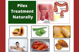 Best Laser Treatment For Hemorrhoids Fissures Fistula Laser Piles Clinic Blog