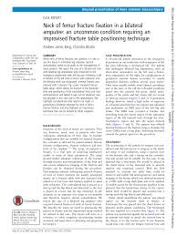 Neck of femur fracture fixation in a bilateral amputee: an uncommon  condition requiring an improvised fracture table positioning