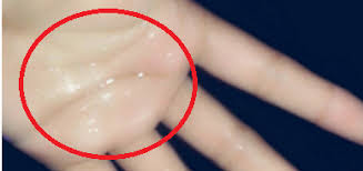 Tapi ternyata perempuan juga bisa mengalaminya. Remaja Perempuan Bangga Tayang Gambar Air Mani Di Media Sosial Oh Meletop