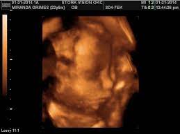 Check spelling or type a new query. This Is My Sweet Baby Boy Aiden At 30 Weeks 3d 4d Ultrasound Looks Like His Daddy 4d Ultrasound Baby Boy 30 Weeks