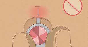 A 14 gauge sterile piercing needle, a 14 gauge belly button ring made from stainless steel, titanium or bioplast, some rubbing alcohol or alcohol wipes, a body ink marker, a piercing clamp and some cotton balls. How To Pierce Your Own Belly Button At Home With Pictures