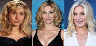 The opening may be on one side, both sides, or in the middle. Elizabeth Mitchell Plastic Surgery Before And After Pictures 2021
