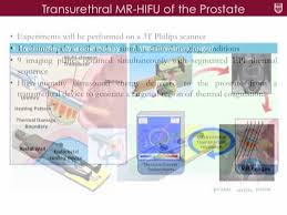 Presentation by Steffen Sammet, MD to the Cancer Research Foundation