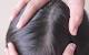 Lice In Blonde Hair