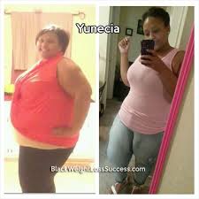 Pin On Before And After Weight Loss Stories