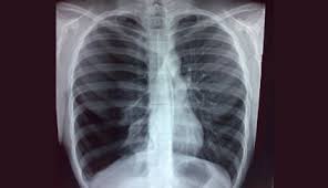 Check spelling or type a new query. This Is A Diagnostic Imaging Clinic Ontario Government Licensed Independent Health Facility To Radiology Clinic In Tor Diagnostic Imaging Mammography Radiology