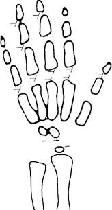 accuracy of skeletal age assessment in children from birth