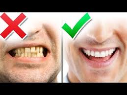 Do it for the smiles! 10 Tips For An Amazing Smile That Attracts The Ladies Youtube
