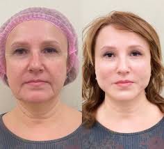 Olga Romanenko» Opinie, ceny