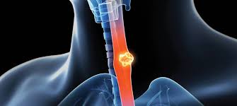 Image result for esophagus