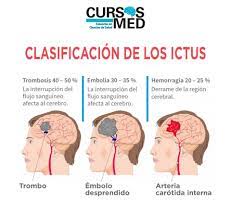 Check out allwealthinfo.com to find what is a thrombosis in your area! Cursos Med Cursosmed El Ictus Tambien Denominado Facebook