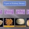 Acute renal failure occurs when renal function suddenly declines to very low levels, so that little or no urine is formed, and the substances, including even water, that the kidney normally eliminates are. 1