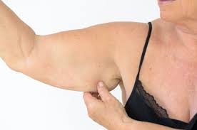 Sarcopenia is the loss of skeletal muscle mass, strength and function associated with the aging process. How To Help Prevent Sarcopenia Or Age Related Muscle Loss The Best Of Health