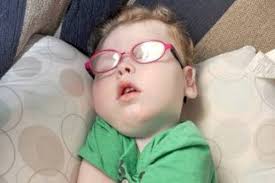 Vancouver man getting word out about Truro girl's rare disorder