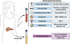 Some dogs have signs that suggest inflammation of the pancreas. Old Dog New Tricks Use Of Ca 19 9 For Early Diagnosis Of Pancreatic Cancer Gastroenterology