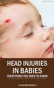 Baby Health Momjunction A Community For Moms Head Injury Toddler Head Injury Baby Health
