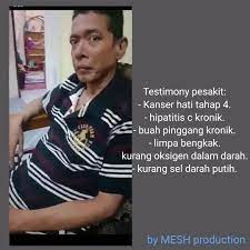 Elyana menghidap kanser tahap 4. Ag Cera Puchong Pes Kit Kanser Hati Tahap 4 Dan Lain2
