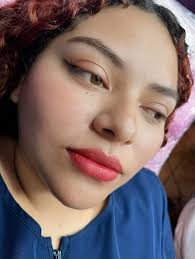 Aumento de labios!!! Excelente Rejuvenecimiento ✨ Elimina Pliegues y  arrugas, aporta volumen Labios más SALUDABLES y HERMOSOS ♥️