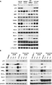 1,107 likes · 18 talking about this. Bcl X L Inhibition Enhances Dinaciclib Induced Cell Death In Soft Tissue Sarcomas Scientific Reports