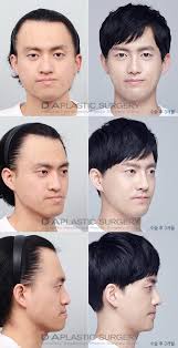 Korean Show Reborn Project For Men Dr Sang Woo Lee Finder Of Da Plastic Surgery Male Transformation Asian Plastic Surgery Face Surgery Male Plastic Surgery