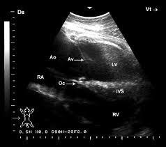 Camel active is an accessories company that is located in the country of kuala lumpur. Echocardiography Of The Normal Camel Camelus Dromedaries Heart Technique And Cardiac Dimensions Bmc Veterinary Research Full Text