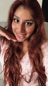 Picaduras de Arañas en el Labio: Tratamiento y Prevención