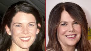 Lauren Graham -- Good Genes or Good Docs?!