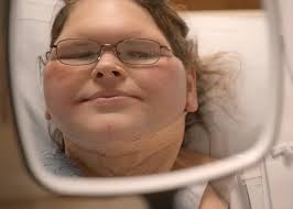 Shocking Transformation Of '1000-lb Sisters' Star Goes Viral After She  Reveals 'Terrifying' 8-Hour Surgery