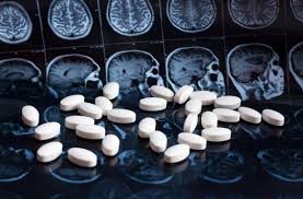 Les vasodilatateurs cérébraux permettant une meilleure. Les Medicaments Anticholinergiques Associes A Un Risque Accru De Maladie D Alzheimer
