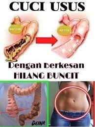 Anda cuma perlu bungkus perut anda dengan plastik cling wrap. Nak Hilangkan Perut Buncit