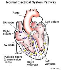 arrhythmias in children cleveland clinic