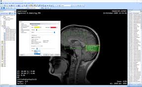 Download dicom viewer for free. Microdicom Dicom Viewer Microdicom Twitter