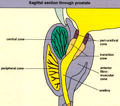 Samson W Fine Md On Twitter In Dr Mcneal S Understanding The Prostate Glandular Zones Emanate From Can Be Described Based On Their Relationship To A 35 Degree Angulation At The Midpoint Of