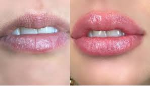 Per se tattoo does not cause skin cancer. Permanent Lip Tattoo All About Lip Blushing Body Art Guru
