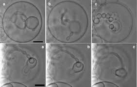This is not for the faint of heart. Reversibility Of Membrane Pearling In Tubes Top Time Lapse Images Of Download Scientific Diagram