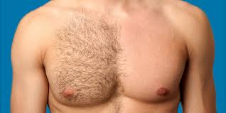 Start studying male pubic hair staging. Do S And Don Ts Of Body Hair Plus Hair Removal Products You Can Trust Askmen