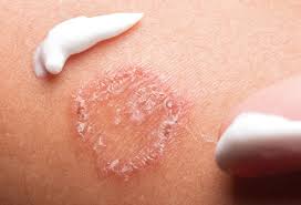 Pictures Of Skin Infections