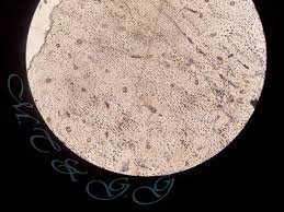 Cok Cesitli Blog Histoloji Lab Fotograflari Destek Doku Kemik Dokusu Sert Kemik Dokusu