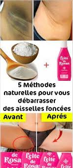 5 Methodes Naturelles Pour Vous Debarrasser Des Aisselles Foncees Aisselles Foncees Creme Depilatoire Aisselles
